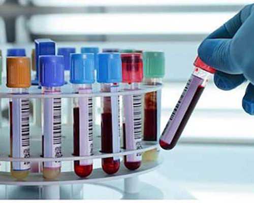 长沙代生正规吗,长沙中信湘雅做供精试管婴儿有什么要求？费用要多少钱？-为