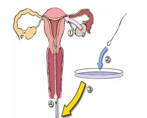长沙代生公司在哪,长沙三代试管婴儿医院哪家好？怎么挑选更适合？