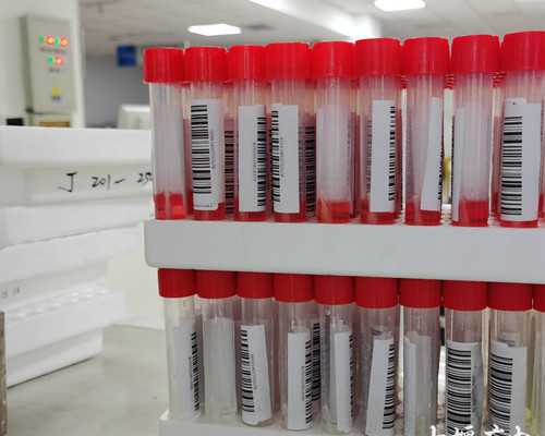 卵巢早衰长沙试管成功率大吗！长沙卵巢早衰看哪个医生！