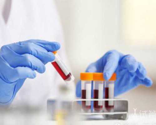 宫寒能吃排毒养颜胶囊吗