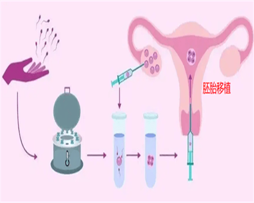 长沙代怀试管婴儿,海有多深，做试管婴儿就有多痛？你信吗？_杭州供卵私立医