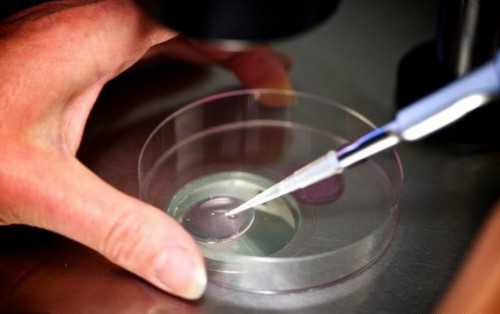 怀孕期间可以做hpv检查吗